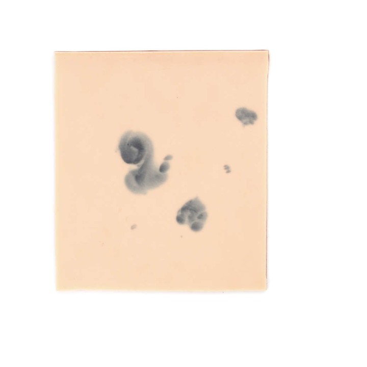 skin pad